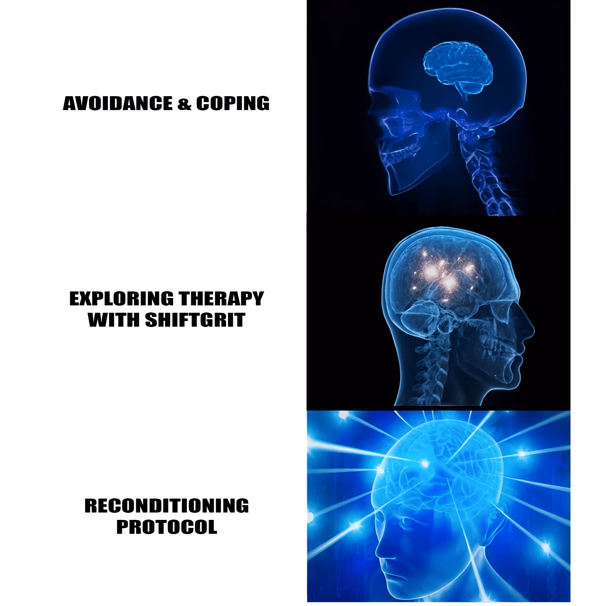 A three-panel “Galaxy Brain” style meme used in the ShiftGrit Glossary. It illustrates the progression from avoidance and coping → exploring therapy with ShiftGrit → the Reconditioning Protocol. The glowing brain stages represent increasing awareness and transformation.